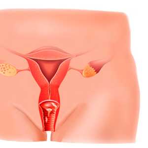 Рак шейки матки