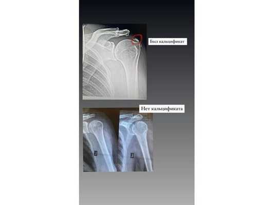 Результат операции