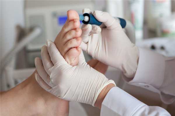 Гиперкератоз