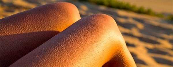 Фолликулярный гиперкератоз