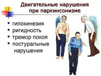 паркинсонизм
