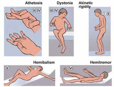 Все нарушения