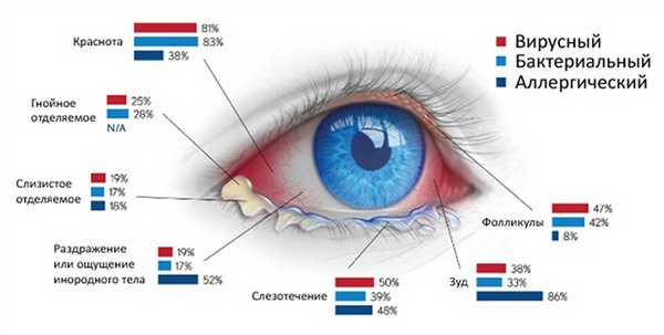 Виды конъюктивита