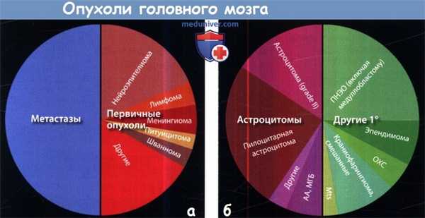 Распространенность опухолей головного мозга
