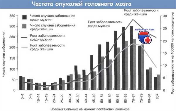 Частота опухолей головного мозга