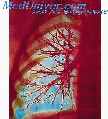 бронхоспирометрия