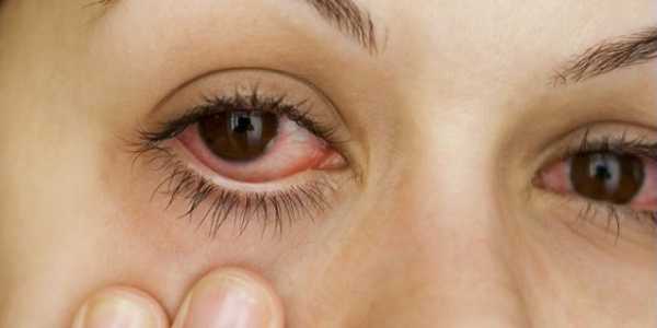 Причины развития воспалительного заболевания глаз