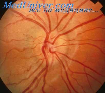 офтальмоскопия