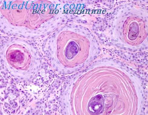обмен веществ в сердце