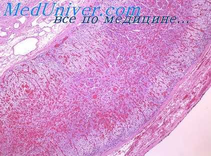 гипертрофированные отделы сердца