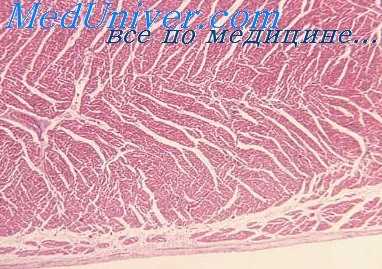 фиброз миокарда