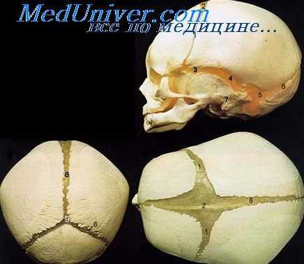 череп плода