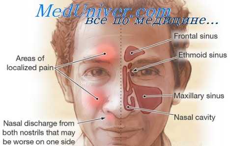 придаточные полости носа