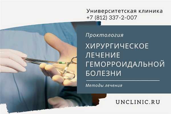 You are currently viewing Хирургическое лечение геморроидальной болезни