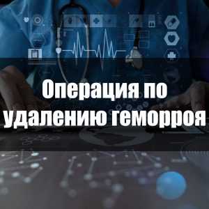 Операция по удалению геморроя