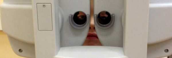 Врожденная глаукома - лечение