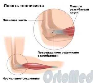анатомия локтевого сустава