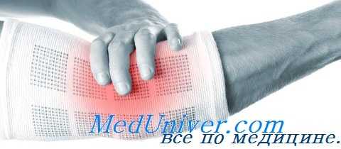 наружный эпикондилит плеча