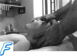 Принципы лечения синдрома длительного сдавления ( СДС ). Доврачебная медицинская помощь. Первая помощь ( неотложная помощь )