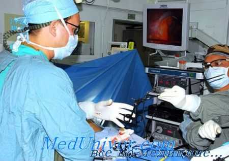 лапароскопическая стерилизация женщин