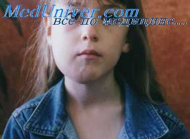 остеомиелит челюсти