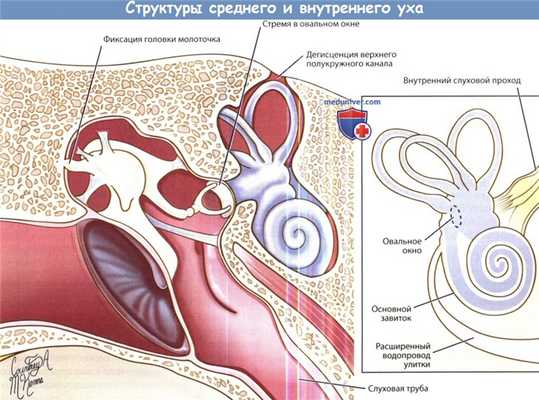 Артериовенозная фистула