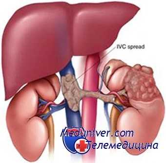 травма почечной артерии