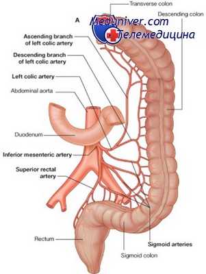 травма сосудов ниже брыжейки
