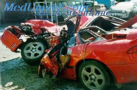 травматический шок