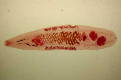 Описторхоз