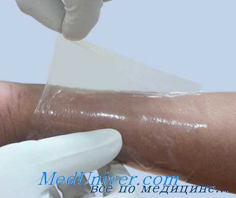 степени ожогов