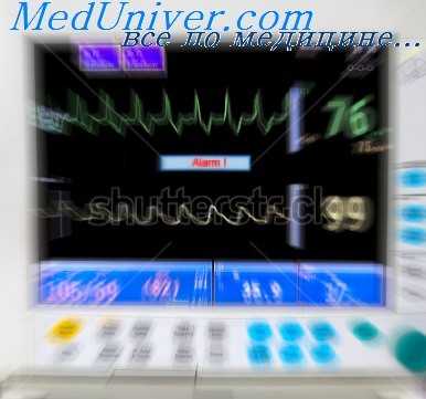 сердечный выброс