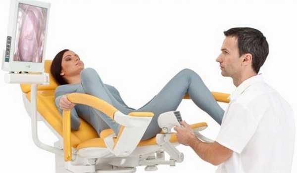 Процедура кольпоскопии