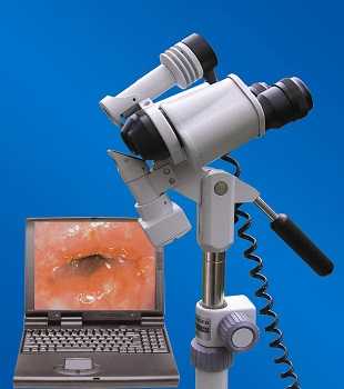 Расширенная кольпоскопия