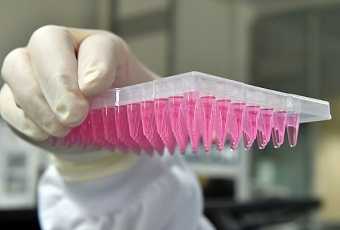 Анализ на C3 компонент комплемента