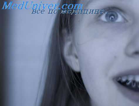 больной с эпилепсией