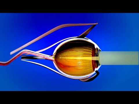 Видео Оптическая система глаза