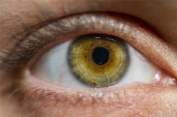 Отслоение сетчатки