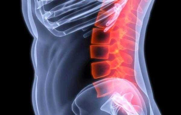 Опухоли позвоночника