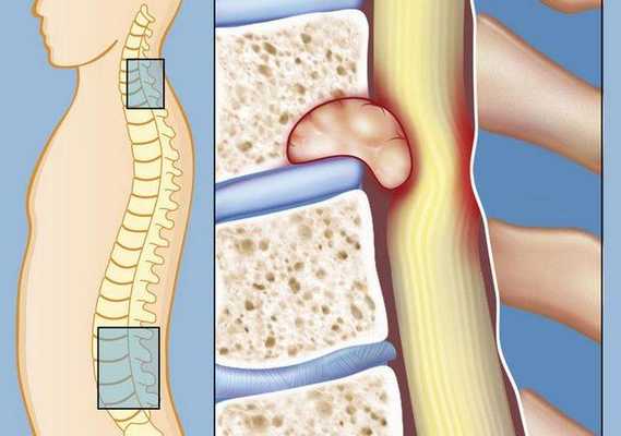 К сожалению, наука так до конца и не может точно ответить, что становится триггером для спящих раковых клеток