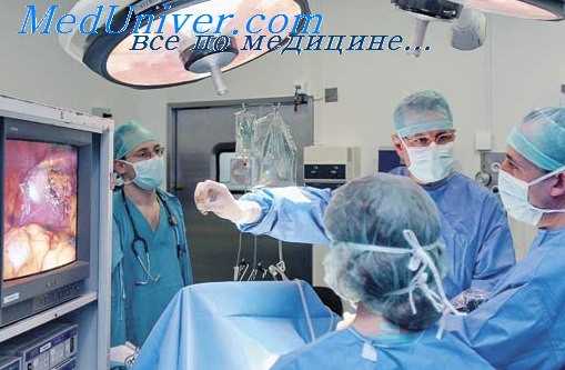 лапароскопия