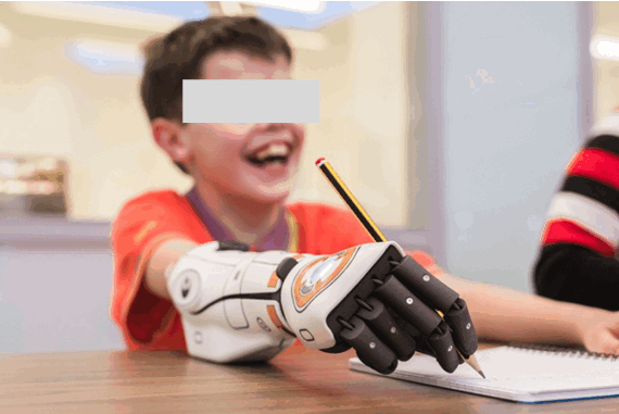 Рис.7 Экзопротез верхних конечностей