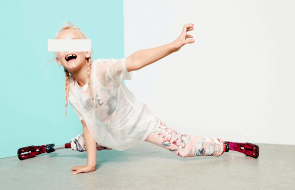 Рис. 8 Экзопротез нижних конечностей