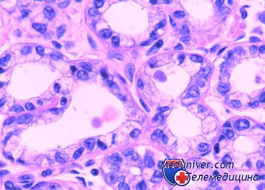 изменения влагалища