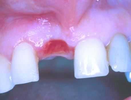 одонтогенные опухоли