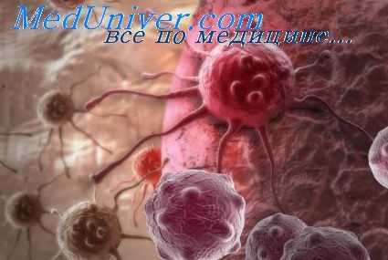 рак поджелудочной железы
