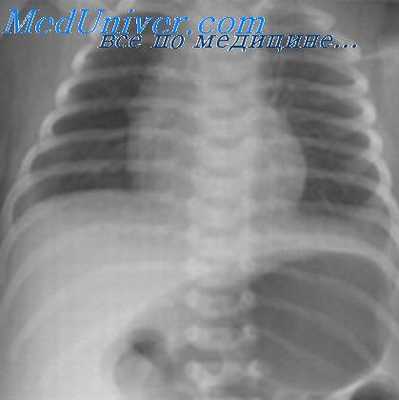 патология стенки желудка