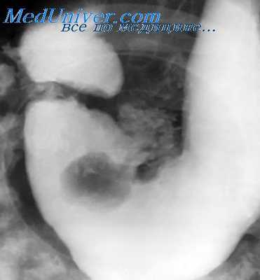 патология желудка