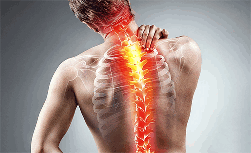 Корсет для позвоночника