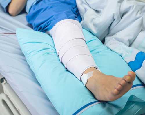 ортез бондаж коленного сустава